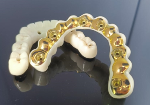 Bar Implan Titanium CAD/CAM+Jambatan Zirconia
