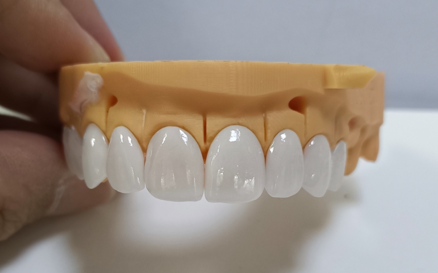 Venir Emax Estetik Tinggi