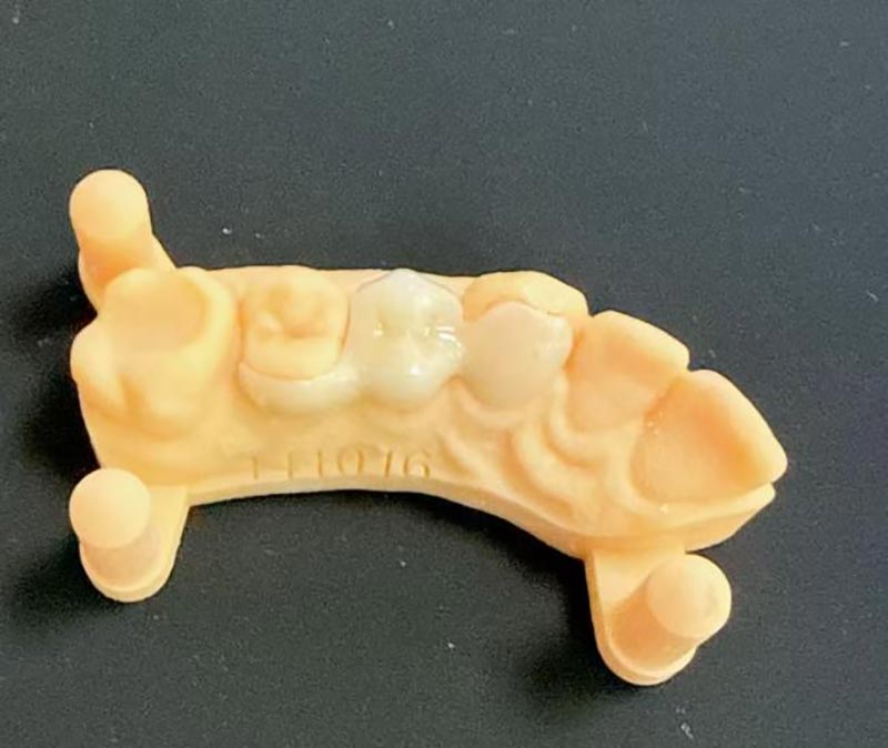 Apa yang Anda Perlu Tahu Mengenai Jambatan Maryland?