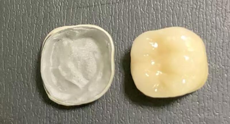 WM DENTAL LAB – Makmal Pergigian China Terkemuka