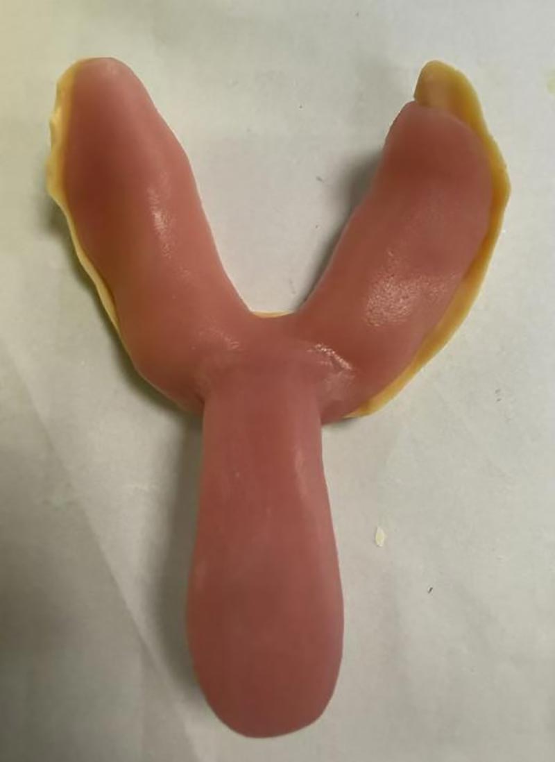 Perkara yang Anda Tidak Tahu Mengenai Dulang Pergigian Tersuai