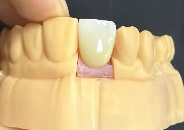 Jurang Antara Gigi Boleh Dibetulkan—Gigi Lurus Adalah Yang Paling Menarik!