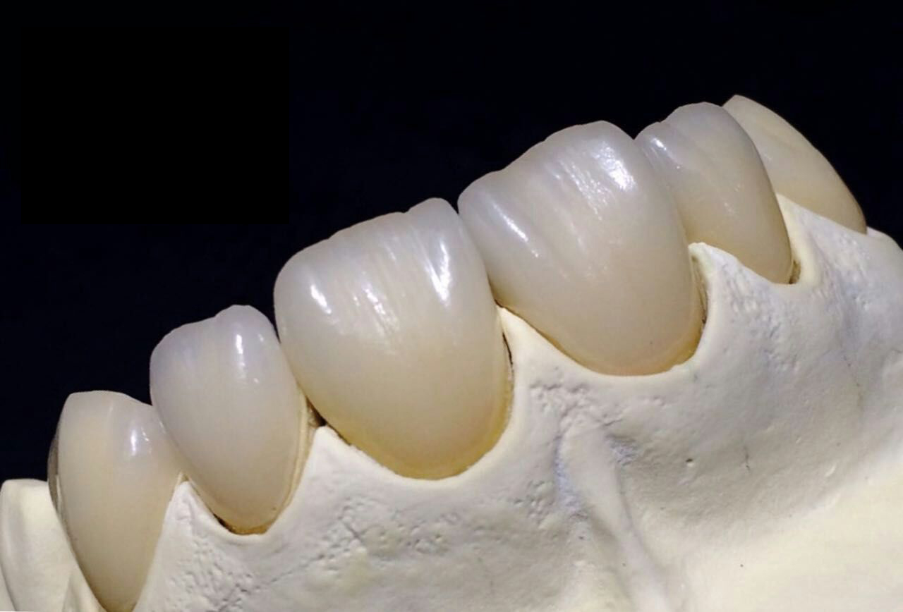 Makmal pergigian penuh Zirconia Crown China