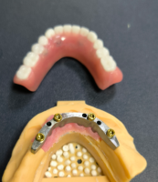 Pencari dan bar pergigian